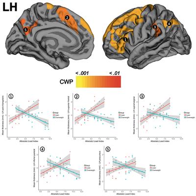 Allostatic Load Is Linked to Cortical Thickness Changes Depending on Body-Weight Status